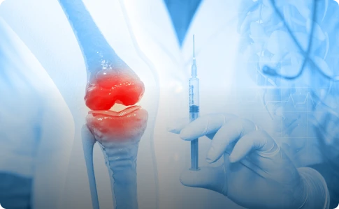 Doctor holding a syringe in front of a knee model, illustrating regenerative therapy techniques.